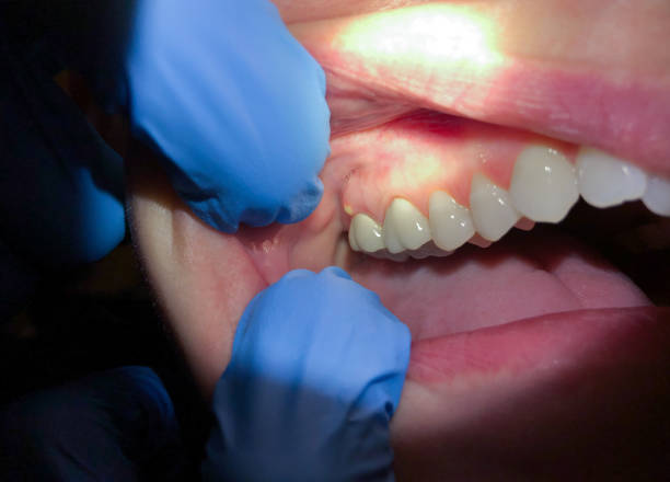  Boulevard Gardens, FL Emergency Dentist Pros